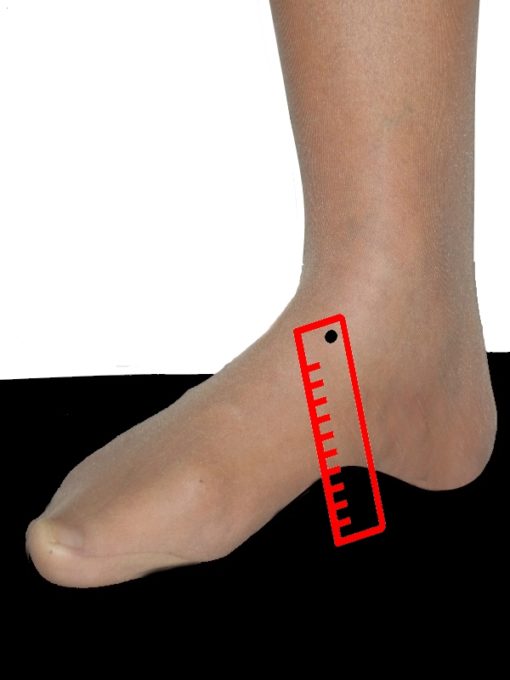 Fußkrankheiten | Exclusive - Schuh und Fußversorgung