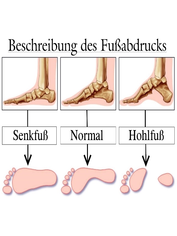 Fußabdrücke und Seitenansicht von Füßen