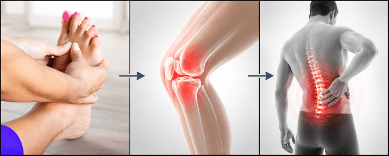 Fußschmerzen können Knie- und Rückenschmerzen verursachen Fuß- und Haltungsbeschwerden erkennen
