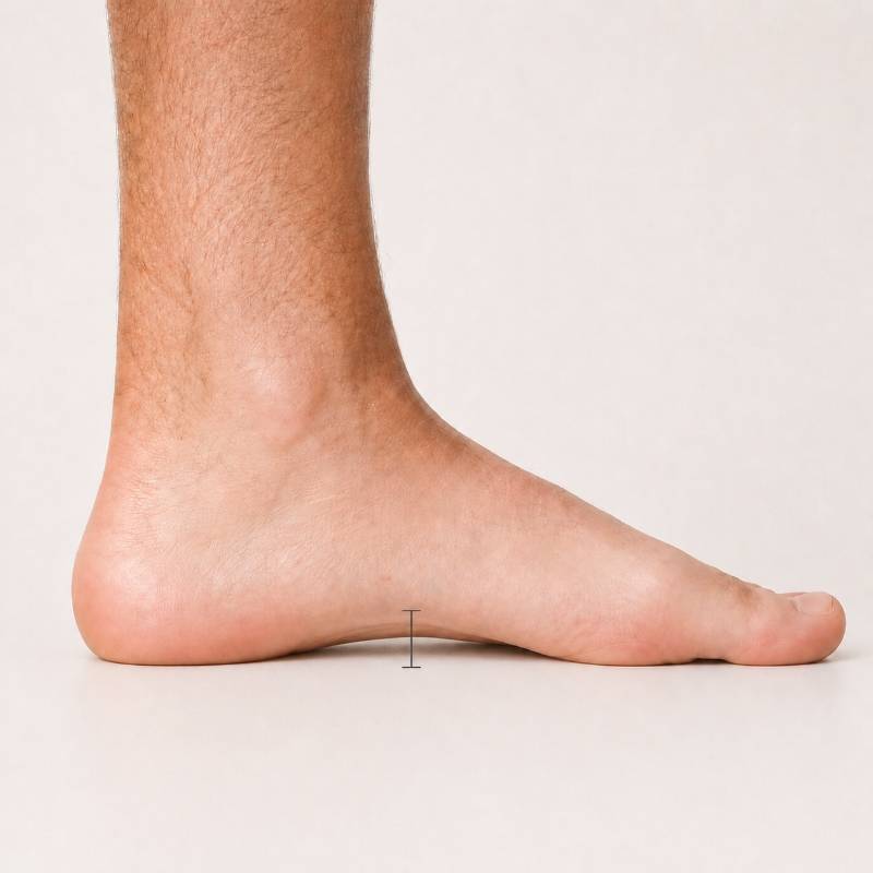 Seitenansicht eines Fußes mit physiologischem Längsgewölbe und markierter optimaler Gewölbehöhe.